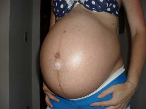 Аппарат сосания сформирован, рост чад достигает сантиметров, а вес около кг что несколько ниже, чем при одноплодной беременности