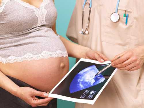 Сроки и цели УЗИ во время беременности