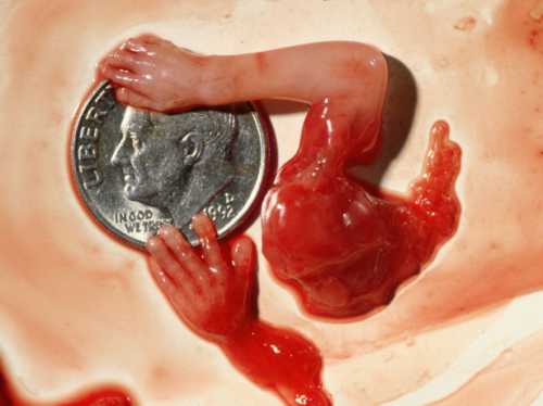 Аборт это насильственное прерывание беременности, во время которой происходит значительная гормональная перестройка организма