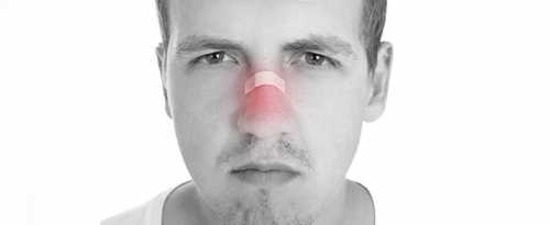 Что делать при ушибе носа, что поможет и что