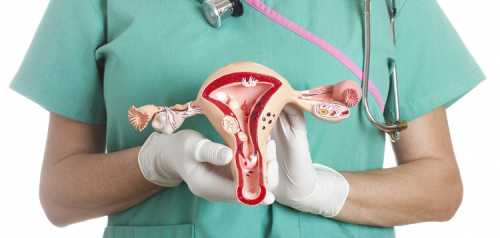 Эндометриоз матки вокруг слизистой оболочки матки, образуется ткань схожая с эндометрием